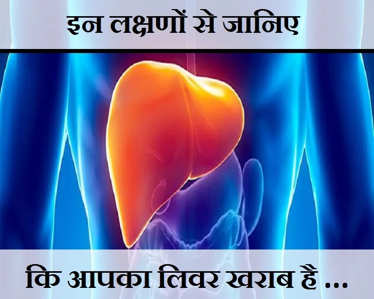 5 signs of overworked liver: कहीं कमजोर तो नहीं हो रहा, आपका लीवर! अगर नजर आए ये लक्षण तो हो जाए सावधान