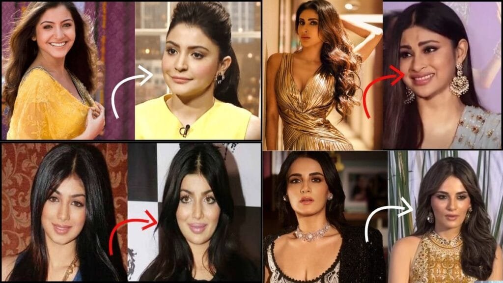 जब खूबसूरत दिखने की चाहत में बिगड़ गया चेहरा: इन बॉलीवुड अभिनेत्रियों पर cosmetic surgery पड़ गई भारी